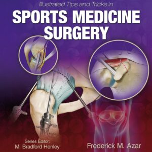 Illustrated Tips and Tricks in Sports Medicine Surgery-ISBN: 9781496375414
