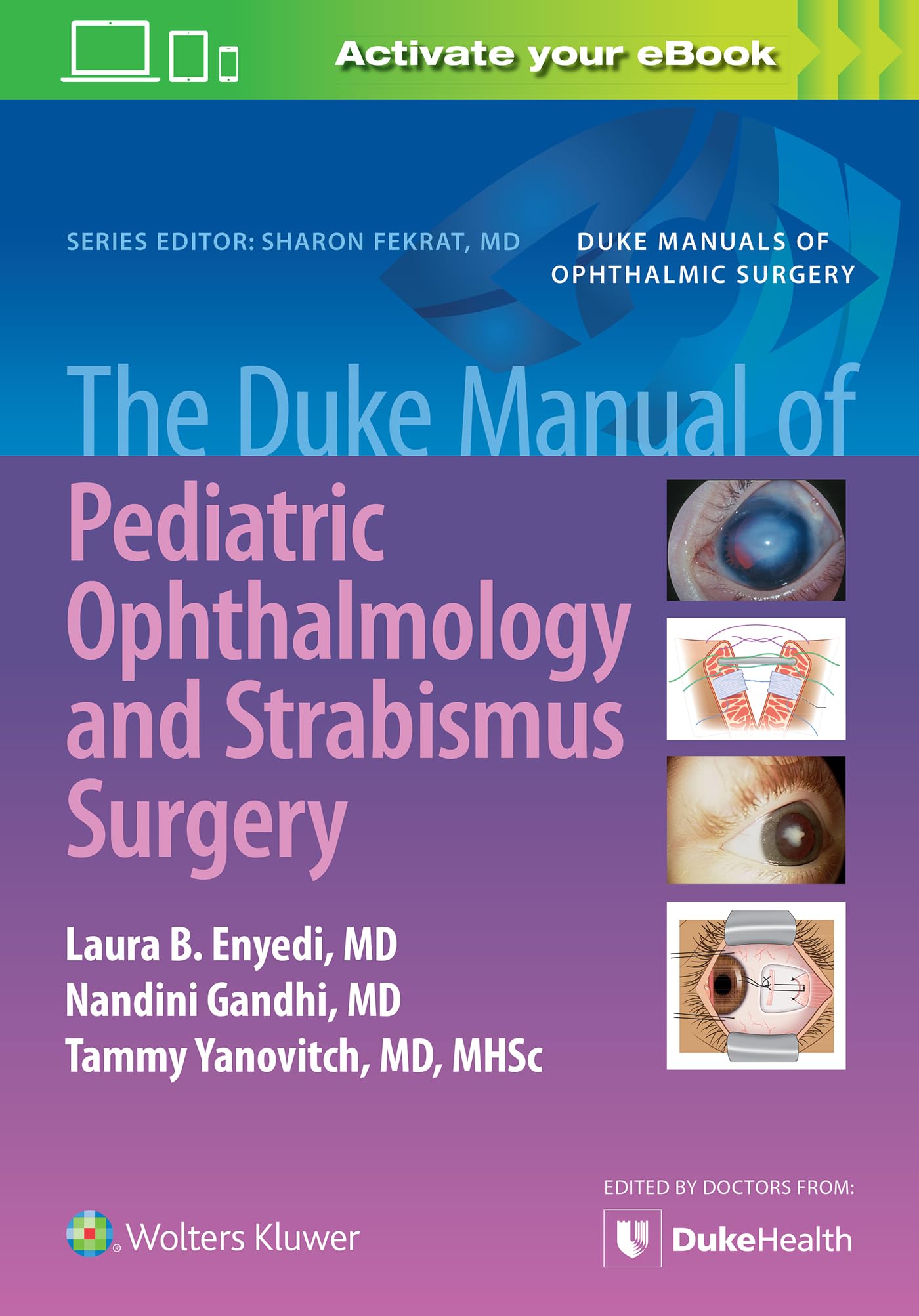The Duke Manual of Pediatric Ophthalmology and Strabismus Surgery-ISBN: 9781975158064
