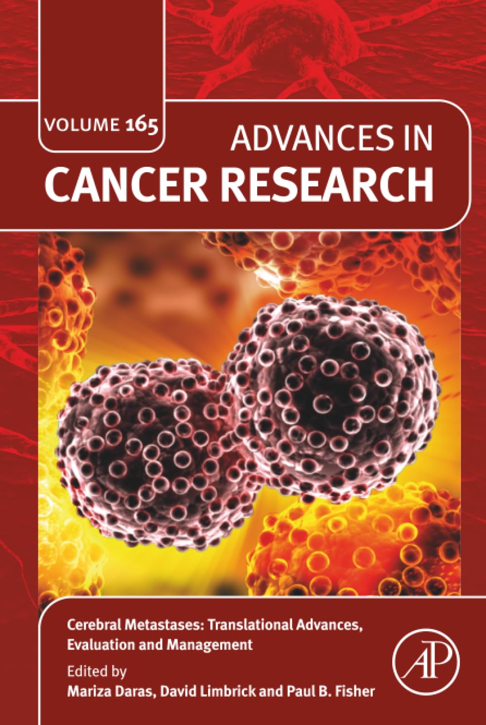 Cerebral Metastases: Translational Advances