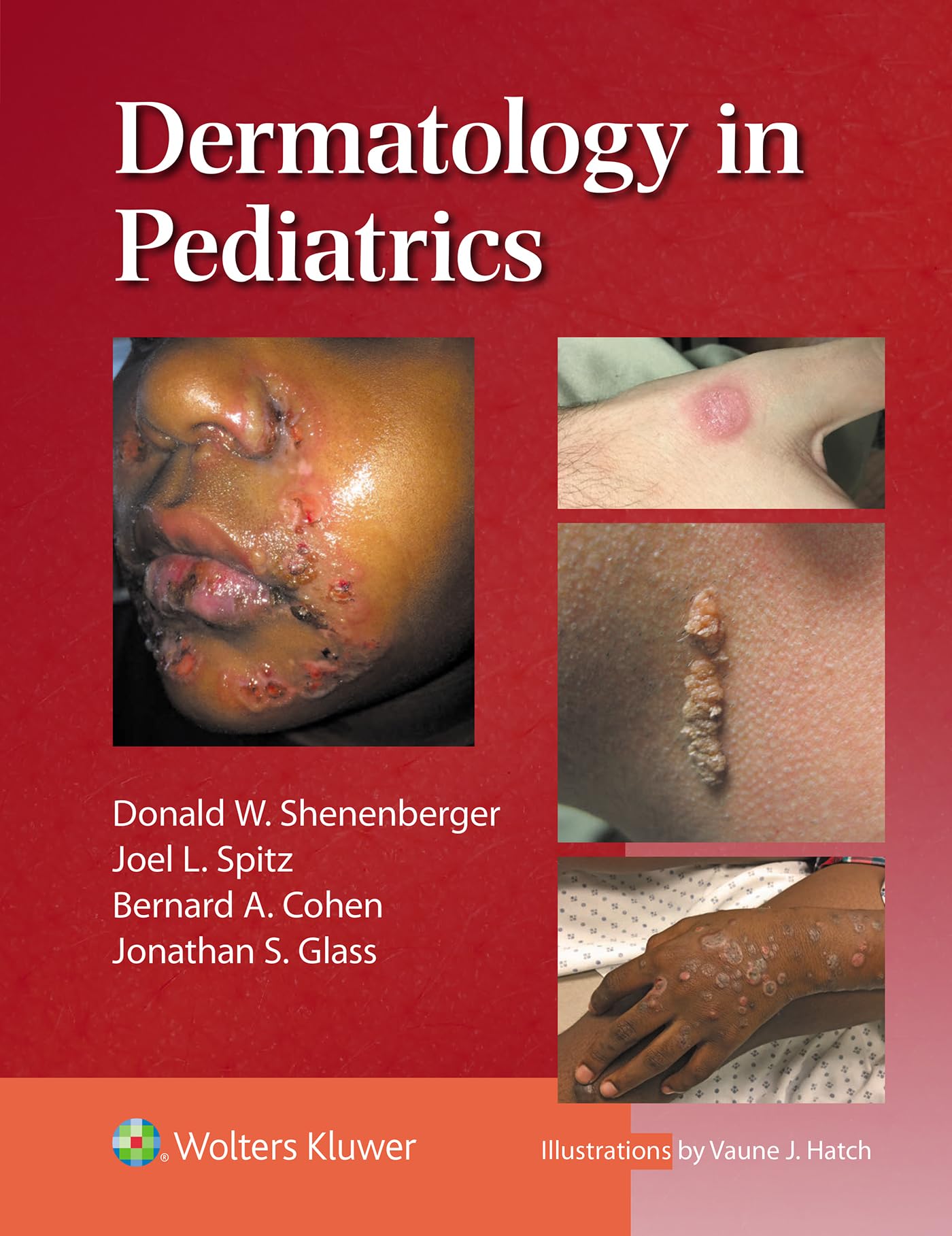 Dermatology in Pediatrics-ISBN: 9781975235383
