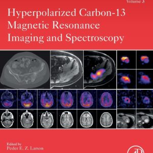 Hyperpolarized Carbon-13 Magnetic Resonance Imaging and Spectroscopy (Volume 3) (Advances in Magnetic Resonance Technology and Applications