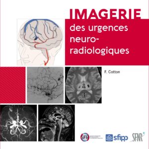 Imagerie des urgences neuroradiologiques