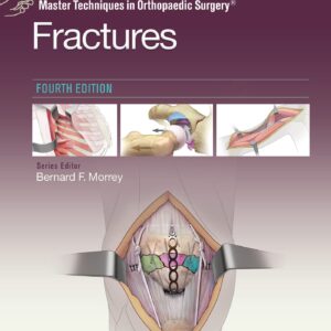 Master Techniques in Orthopaedic Surgery: Fractures-ISBN: 9781975139407
