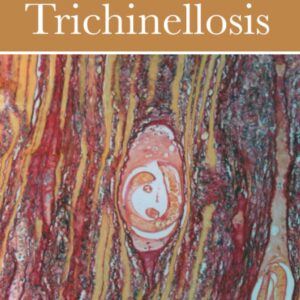 Trichinella and Trichinellosis