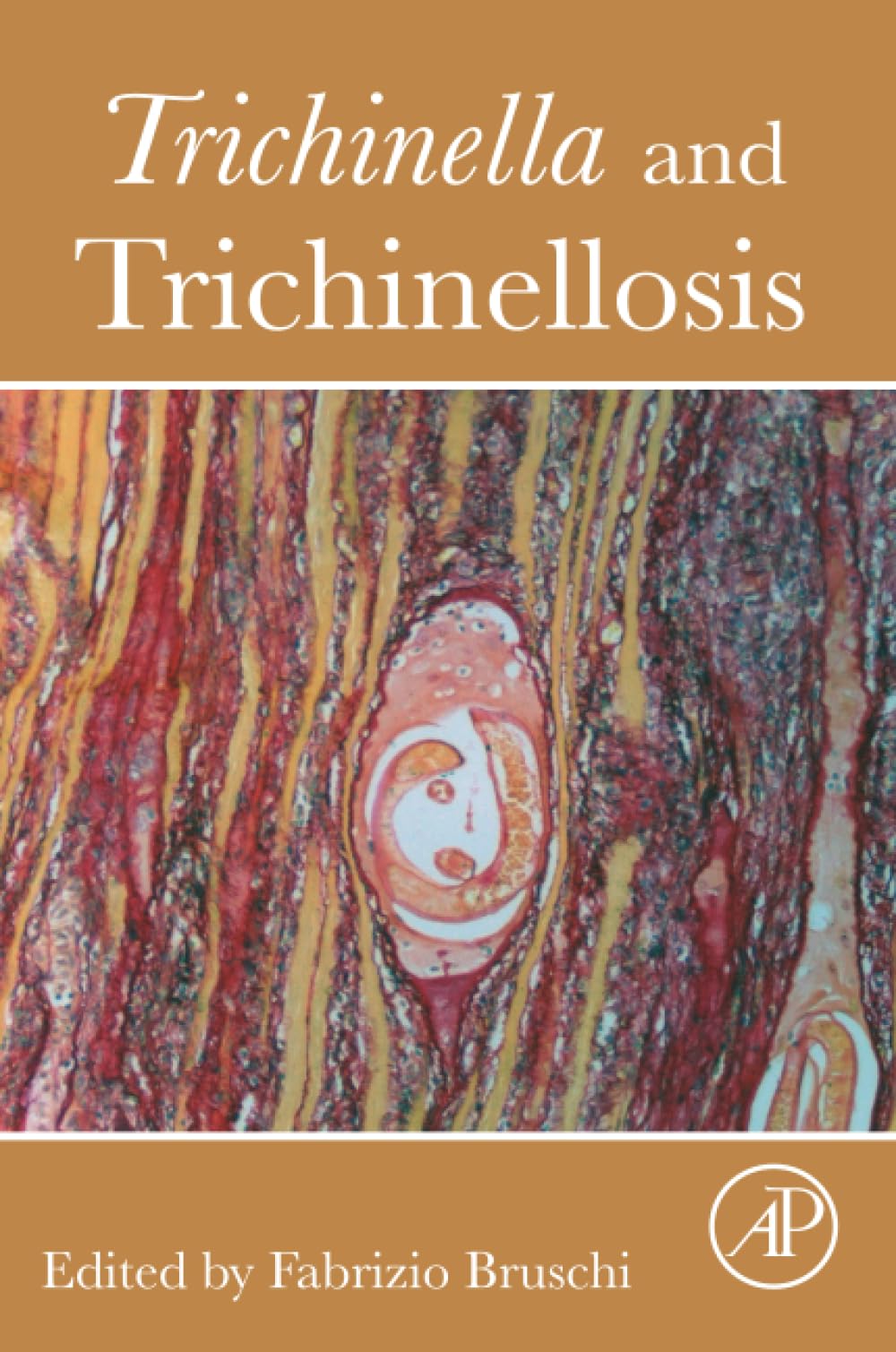 Trichinella and Trichinellosis