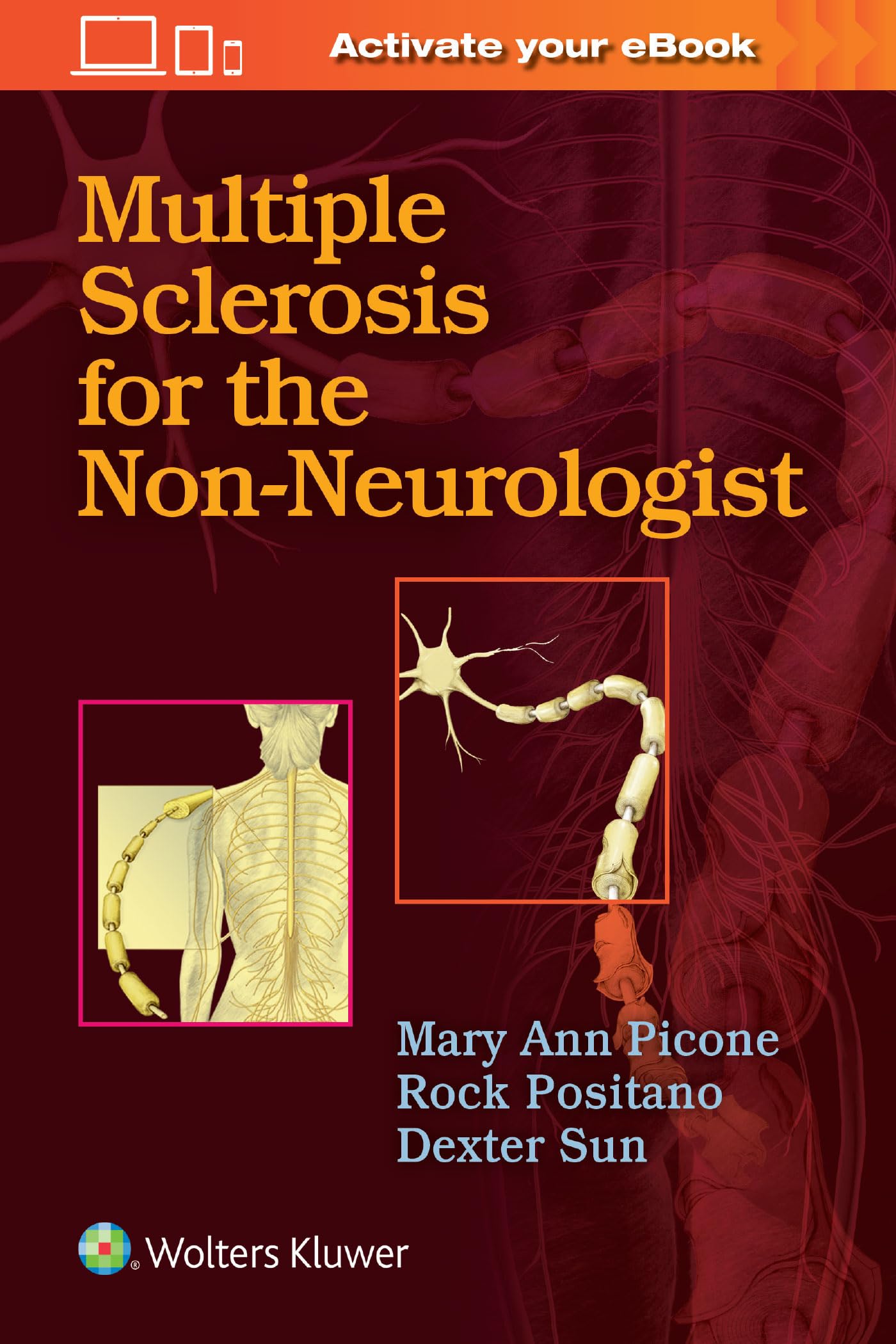 Multiple Sclerosis for the Non-Neurologist-ISBN: 9781975102517