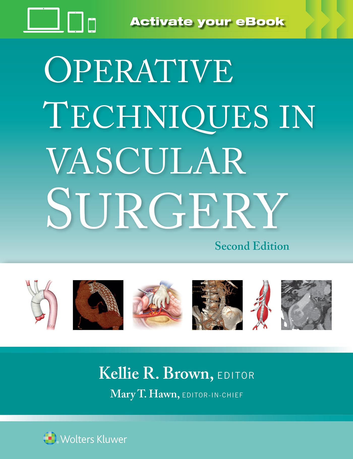 Operative Techniques in Vascular Surgery: Print + eBook with Multimedia-ISBN: 9781975176648