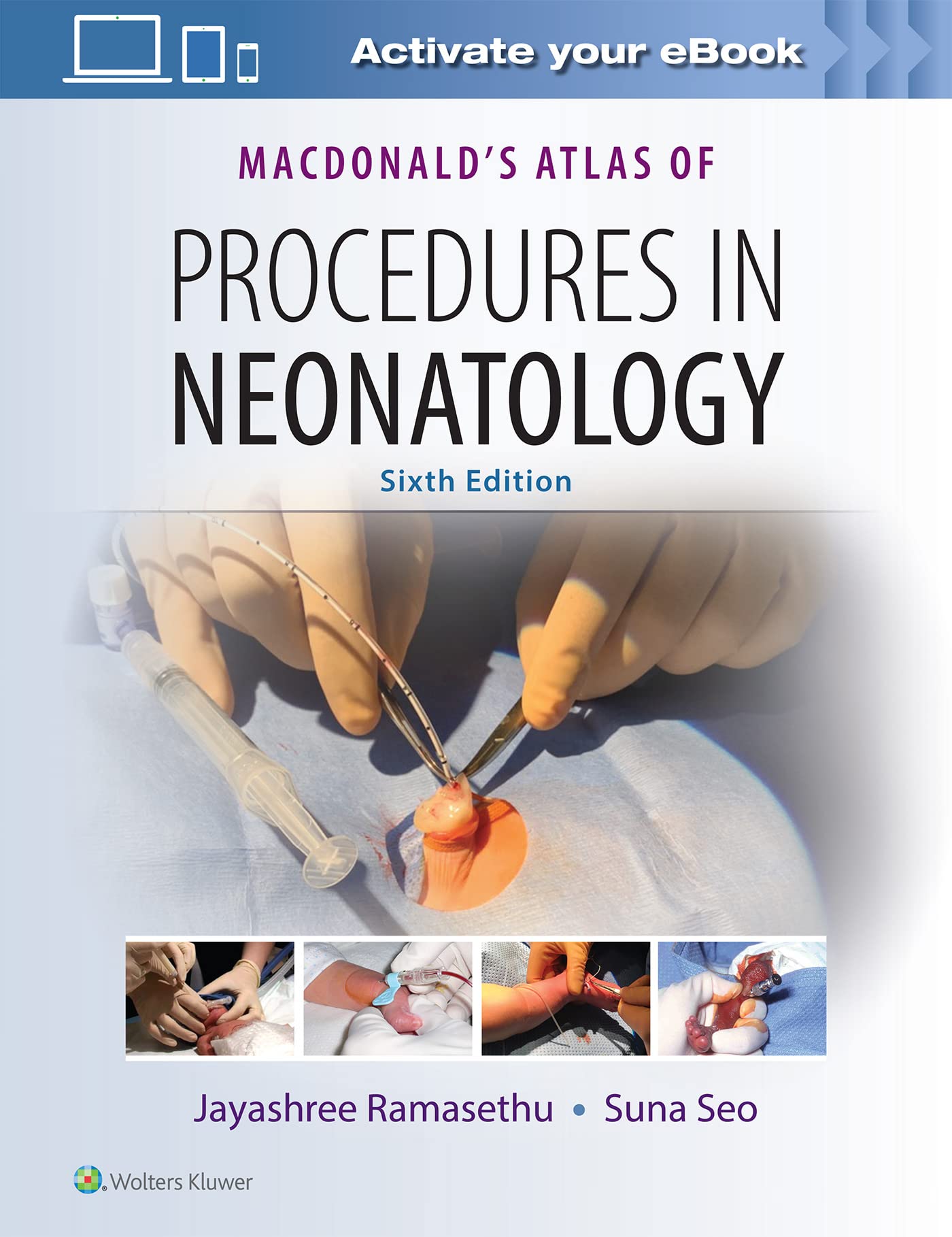 MacDonald's Atlas of Procedures in Neonatology-ISBN: 9781496394255