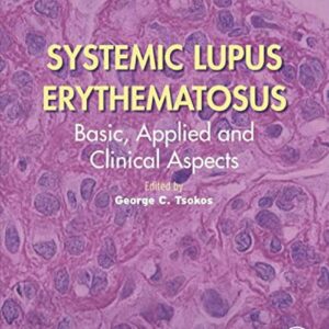 Systemic Lupus Erythematosus: Basic