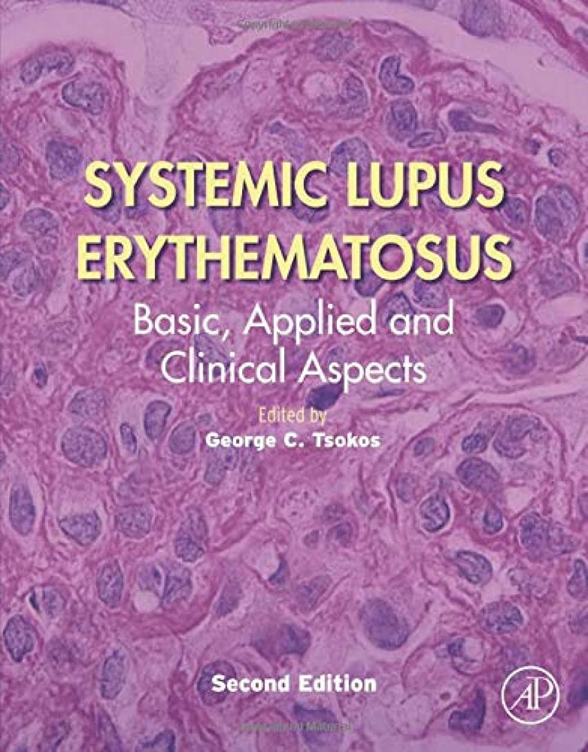 Systemic Lupus Erythematosus: Basic