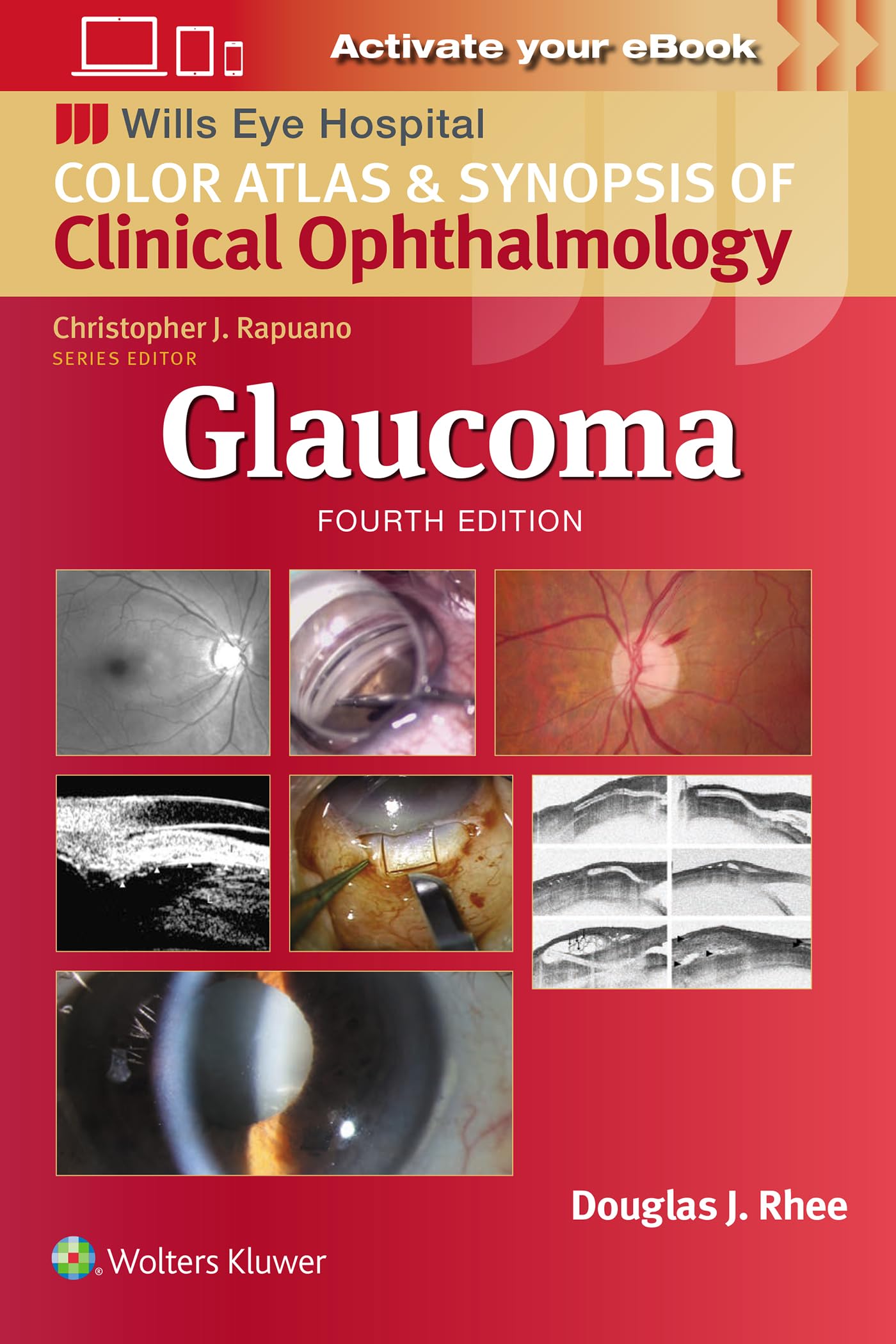 Glaucoma (Wills Eye Institute Atlas Series)-ISBN: 9781975214814