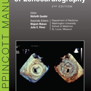The Washington Manual of Echocardiography-ISBN: 9781496321282