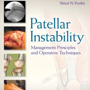 Patellar Instability: Management Principles and Operative Techniques-ISBN: 9781496380821