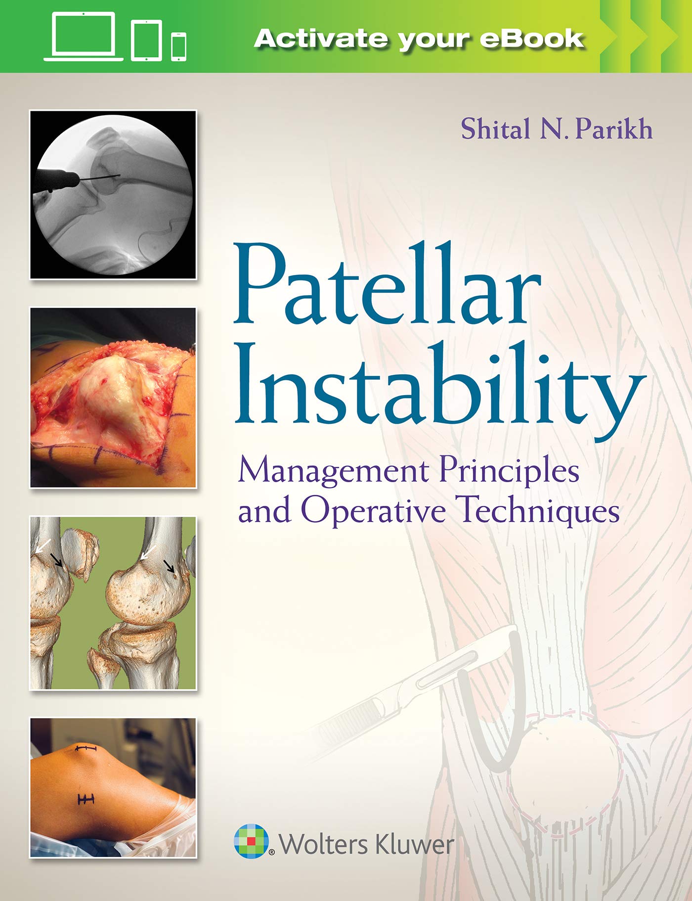 Patellar Instability: Management Principles and Operative Techniques-ISBN: 9781496380821