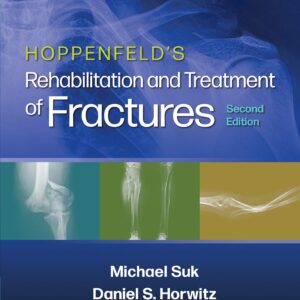 Hoppenfeld's Treatment and Rehabilitation of Fractures-ISBN: 9781451185683