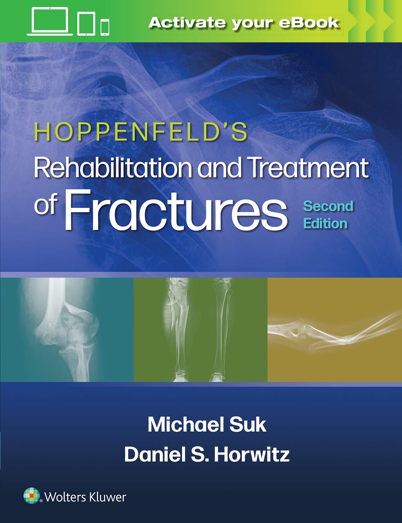 Hoppenfeld's Treatment and Rehabilitation of Fractures-ISBN: 9781451185683