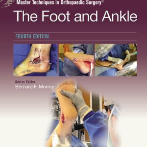 Master Techniques in Orthopaedic Surgery: The Foot and Ankle: Print + eBook with Multimedia-ISBN: 9781975199418