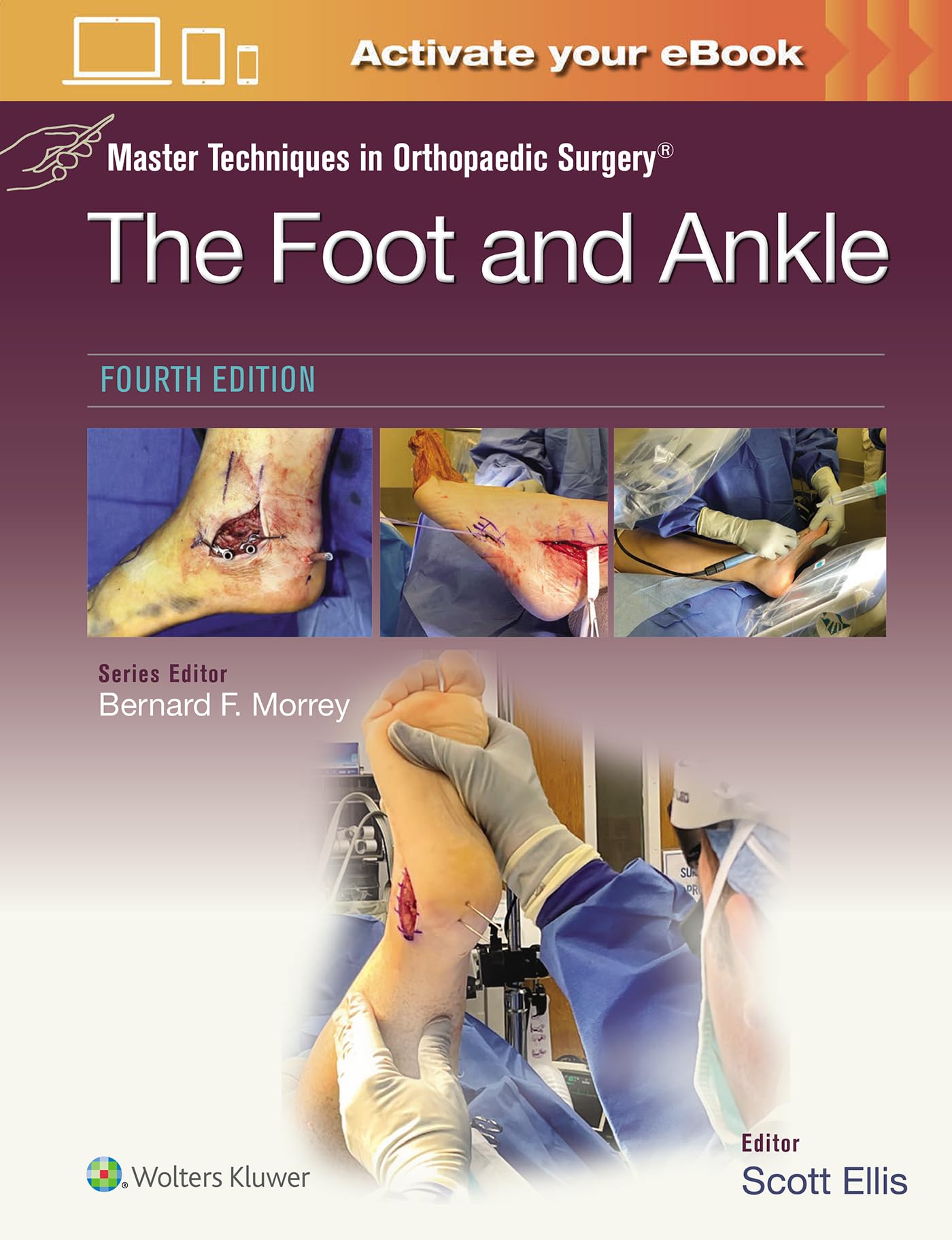 Master Techniques in Orthopaedic Surgery: The Foot and Ankle: Print + eBook with Multimedia-ISBN: 9781975199418