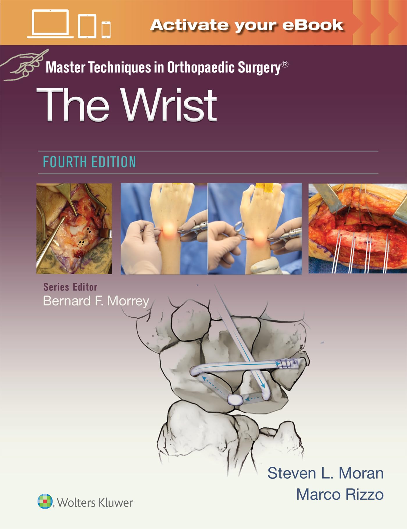 Master Techniques in Orthopaedic Surgery: The Wrist: Print + eBook with Multimedia-ISBN: 9781975215750
