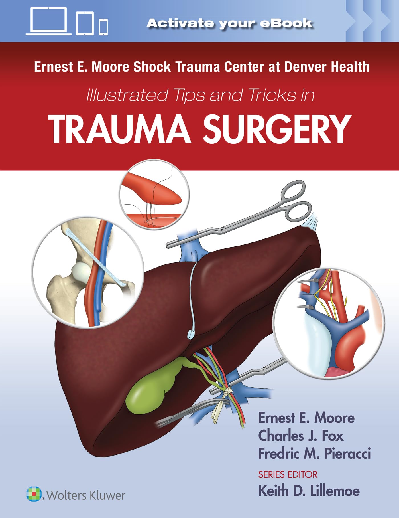 Ernest E. Moore Shock Trauma Center at Denver Health Illustrated Tips and Tricks in Trauma Surgery-ISBN: 9781975109516