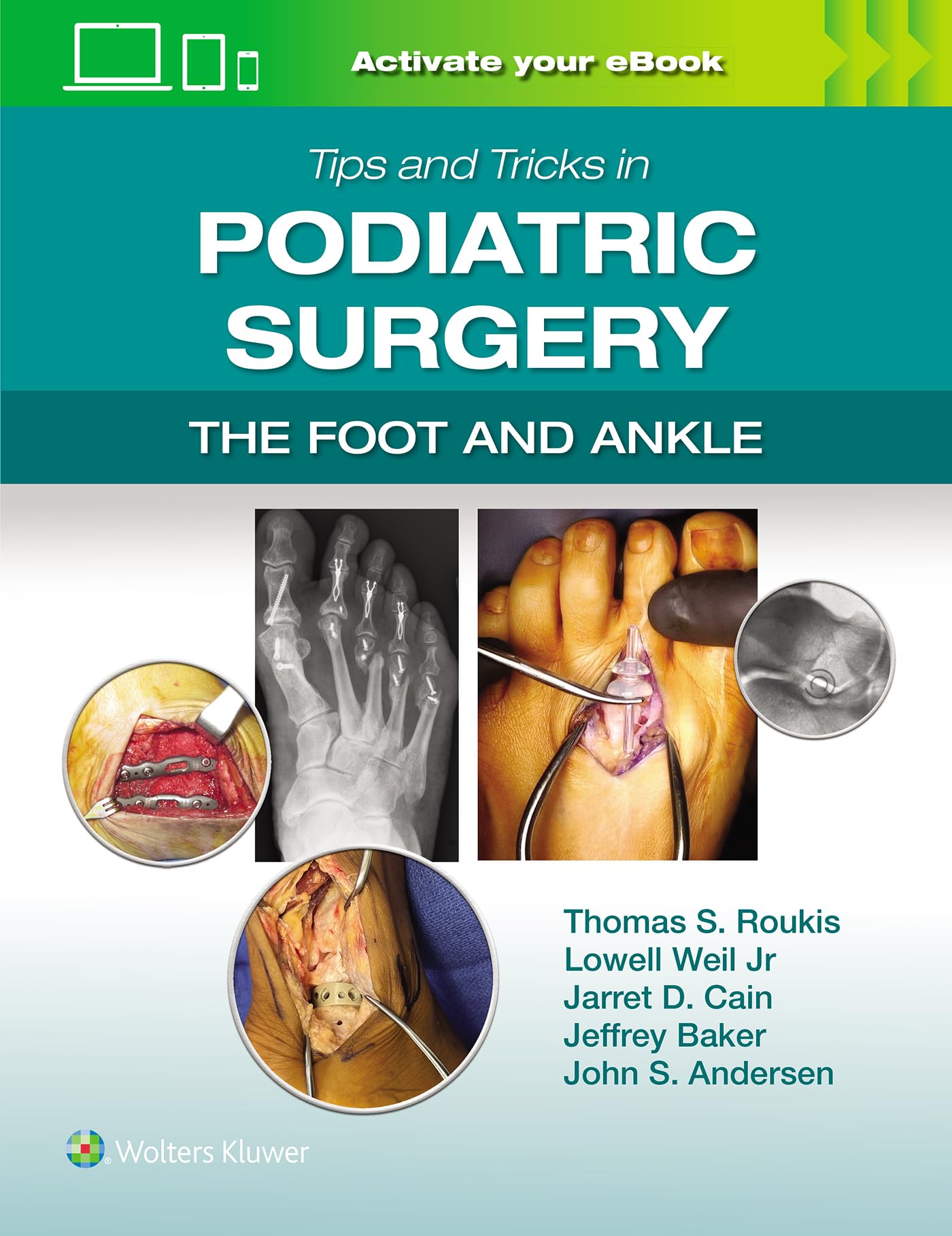 Tips and Tricks in Podiatric Surgery: The Foot and Ankle: Print + eBook with Multimedia-ISBN: 9781975240592