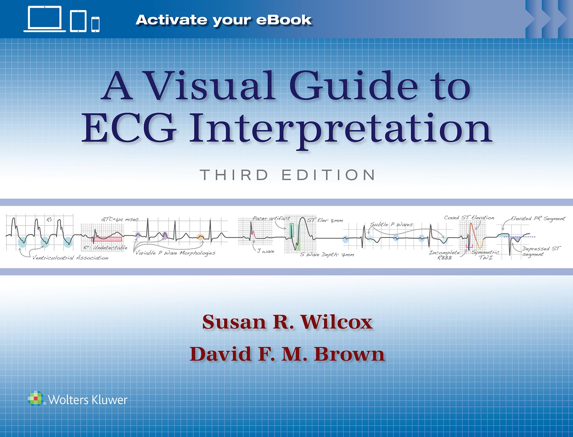 A Visual Guide to ECG Interpretation: Print + eBook with Multimedia-ISBN: 9781975213589