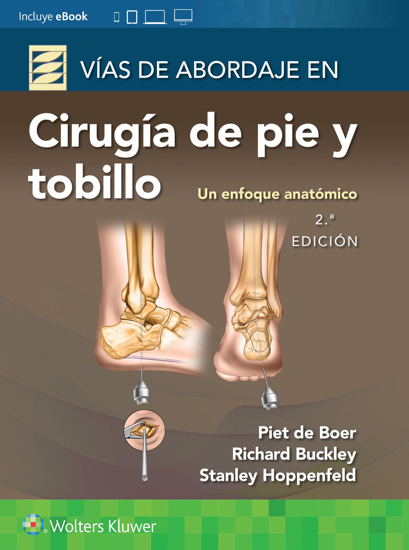 VÃas de abordaje de cirugÃa de pie y tobillo. Un enfoque anatómico (Spanish Edition)-ISBN: 9788419284891