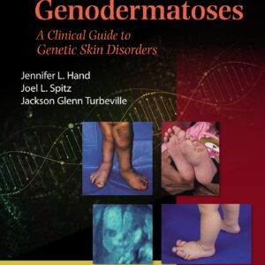 Spitz's Genodermatoses: A Full Color Clinical Guide to Genetic Skin Disorders-ISBN: 9781451116519