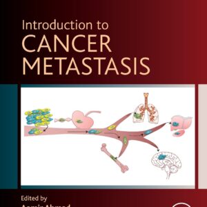 Introduction to Cancer Metastasis