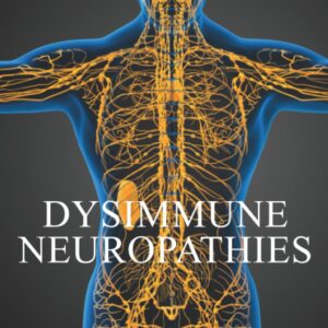 Dysimmune Neuropathies