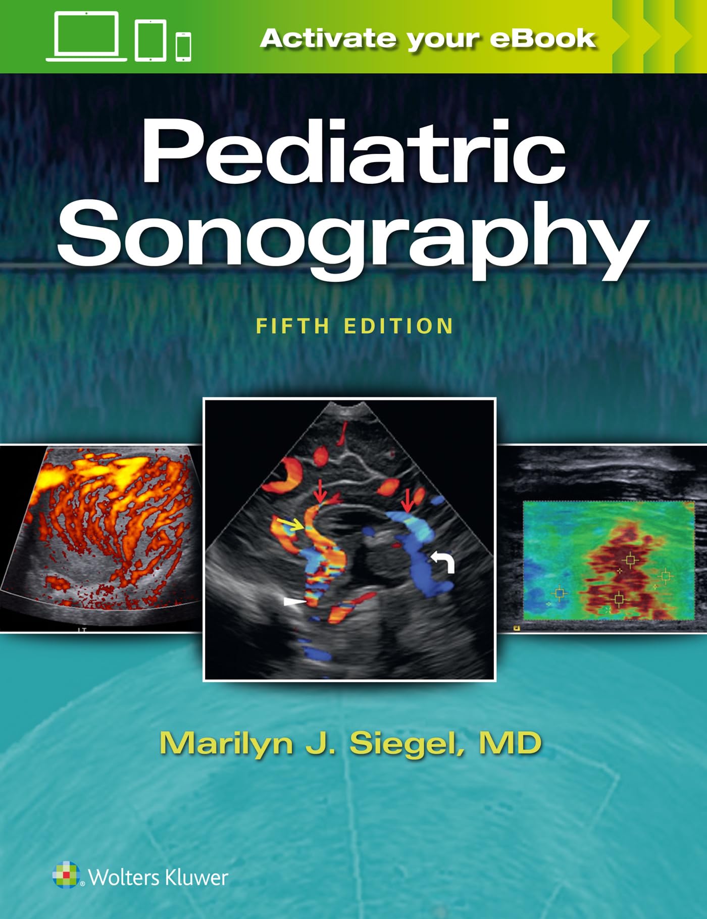 Pediatric Sonography-ISBN: 9781496370563