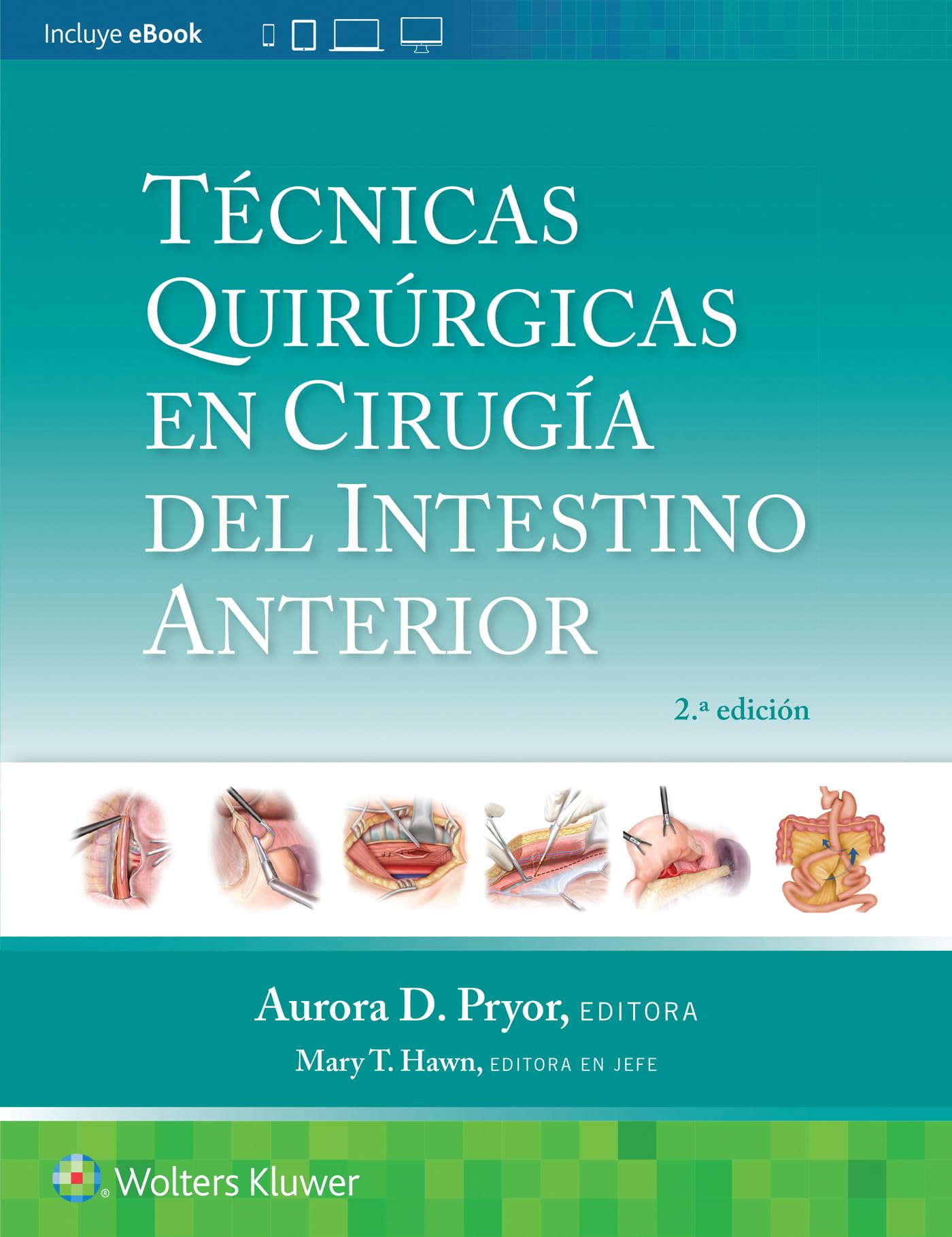 Técnicas quirúrgicas en cirugÃa del intestino anterior (Spanish Edition)-ISBN: 9788419663252