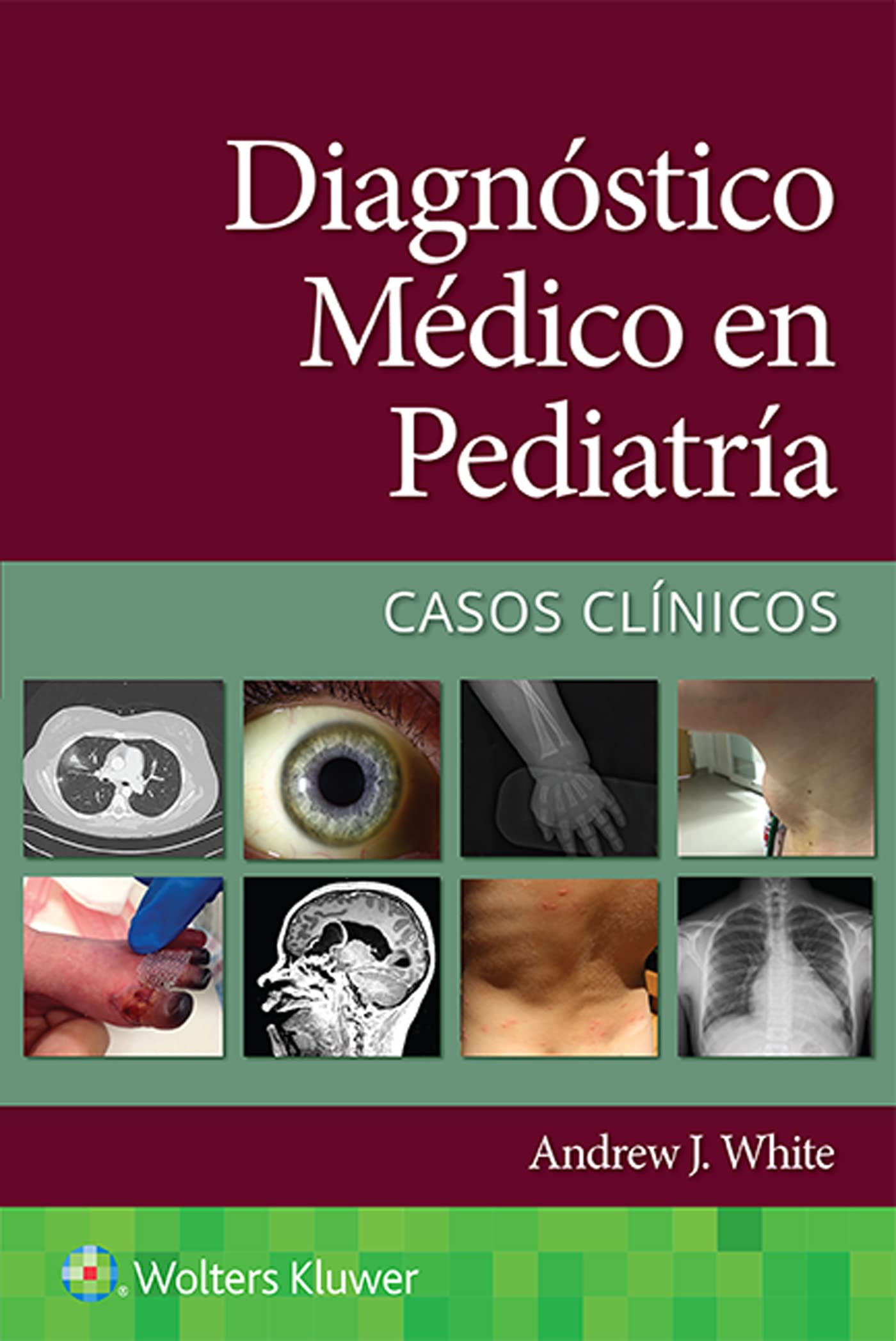 Diagnóstico médico en pediatrÃa. Casos clÃnicos (Spanish Edition)-ISBN: 9788418892615