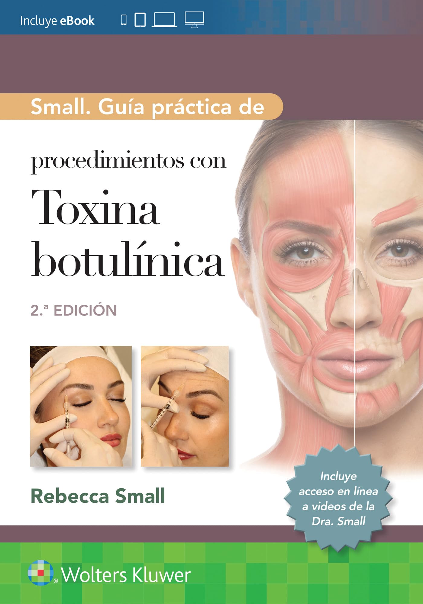 Small. GuÃa práctica de procedimientos con toxina botulÃnica (Spanish Edition)-ISBN: 9788410022270