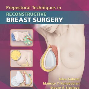 Prepectoral Techniques in Reconstructive Breast Surgery-ISBN: 9781496388278
