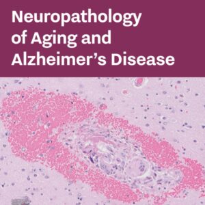 Neuropathology of Aging and Alzheimer’s Disease