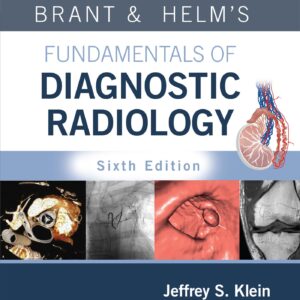 Brant & Helms' Fundamentals of Diagnostic Radiology: Print + eBook with Multimedia-ISBN: 9781975199005