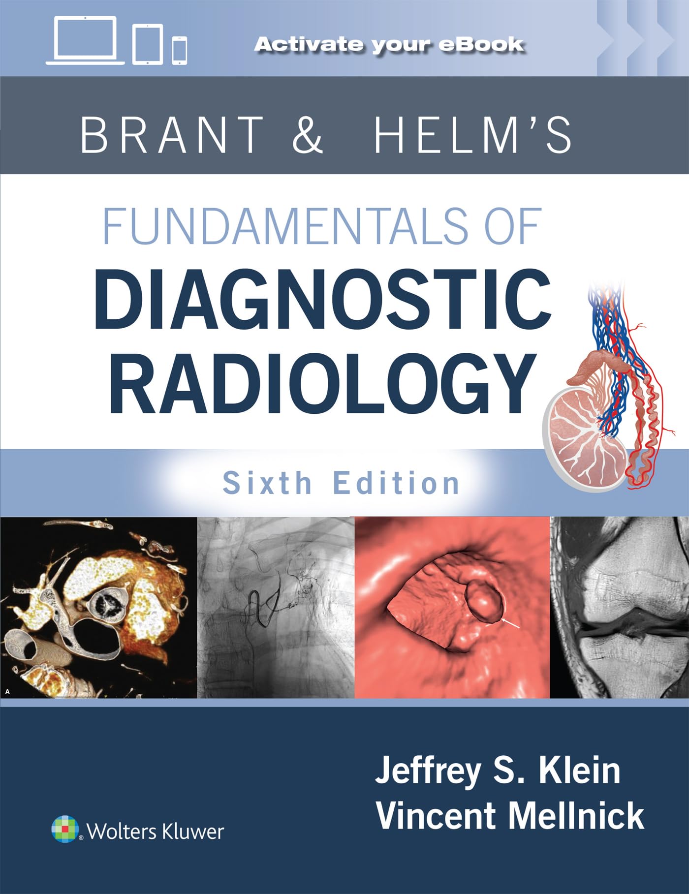 Brant & Helms' Fundamentals of Diagnostic Radiology: Print + eBook with Multimedia-ISBN: 9781975199005