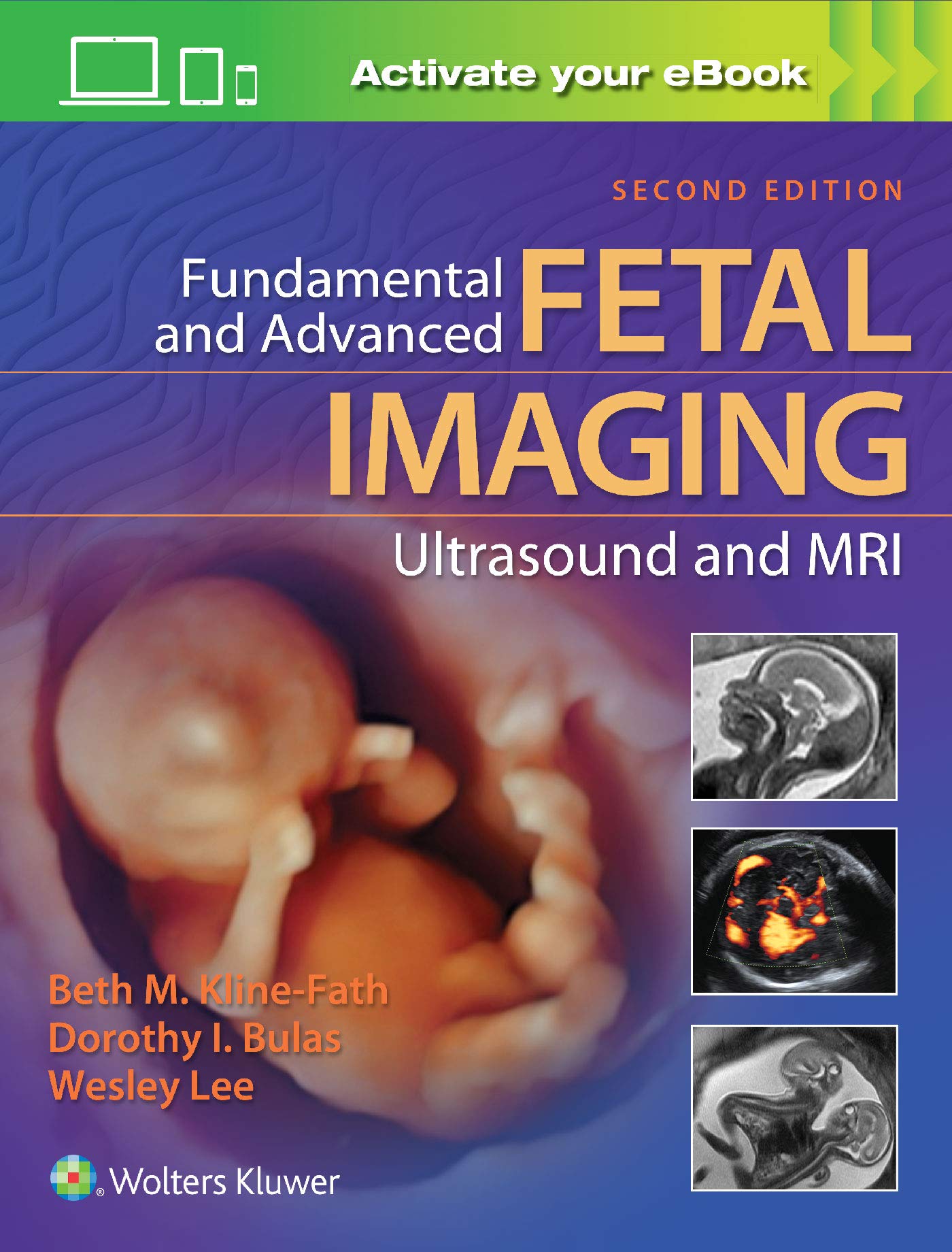 Fundamental and Advanced Fetal Imaging Ultrasound and MRI-ISBN: 9781975117009