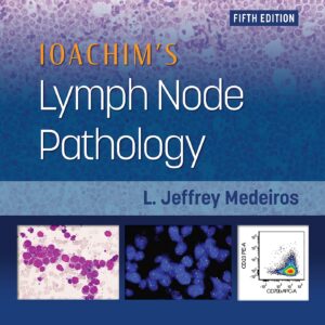 Ioachim's Lymph Node Pathology-ISBN: 9781451193572