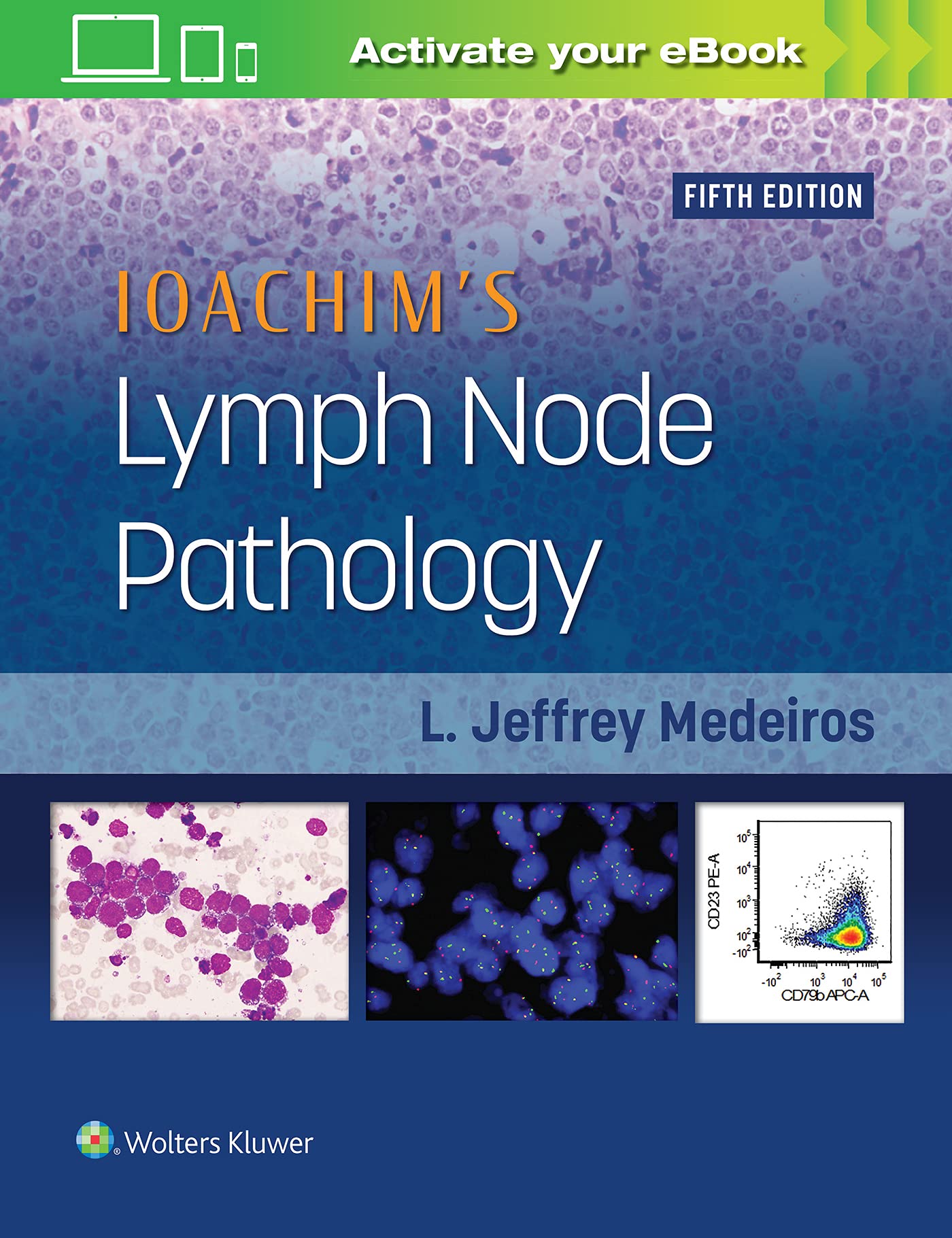Ioachim's Lymph Node Pathology-ISBN: 9781451193572