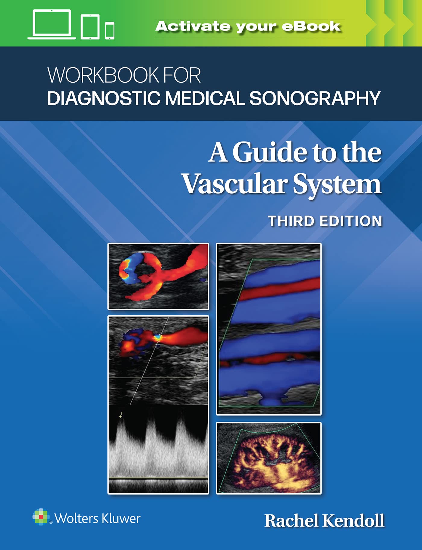 Workbook for Diagnostic Medical Sonography: The Vascular Systems (Lippincott Connect)-ISBN: 9781975177072