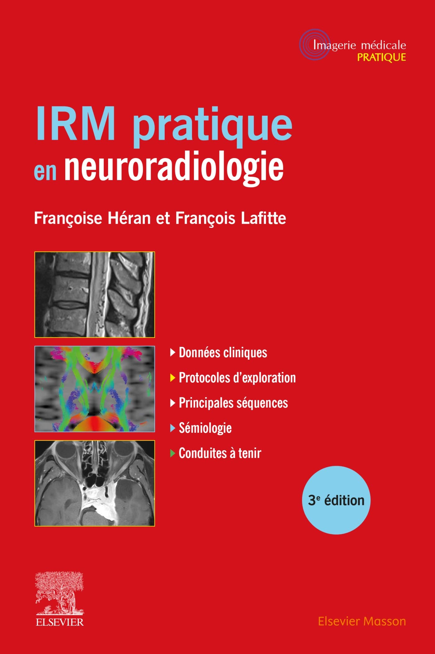 IRM pratique en neuroradiologie (French Edition)