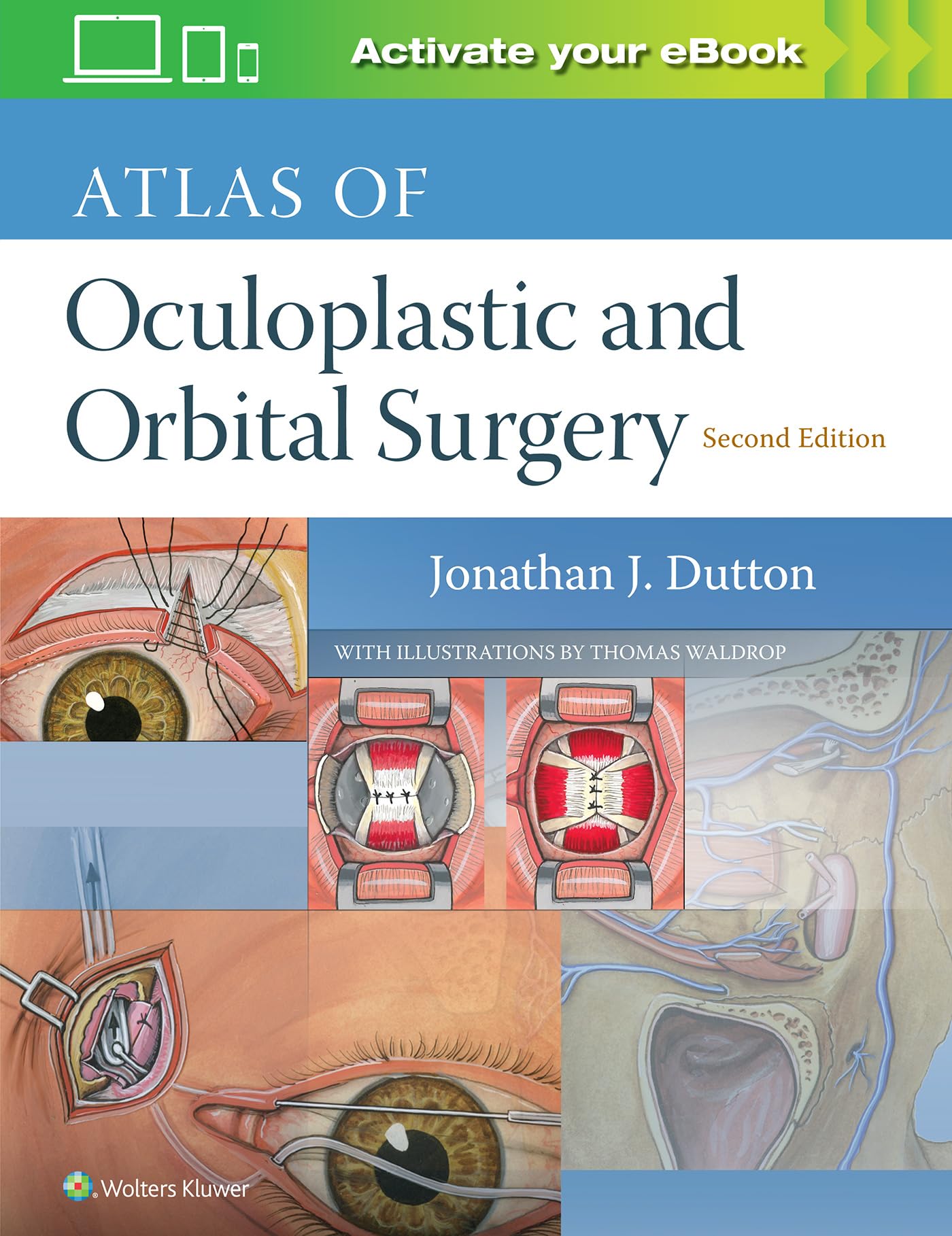 Atlas of Oculoplastic and Orbital Surgery-ISBN: 9781496390813