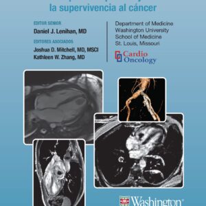 Manual Washington de CardiooncologÃ­a: GuÃ­a prÃ¡ctica para mejorar la supervivencia al cÃ¡ncer (Spanish Edition)-ISBN: 9788419284365