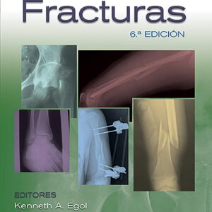 Manual de fracturas (Spanish Edition)-ISBN: 9788417949440