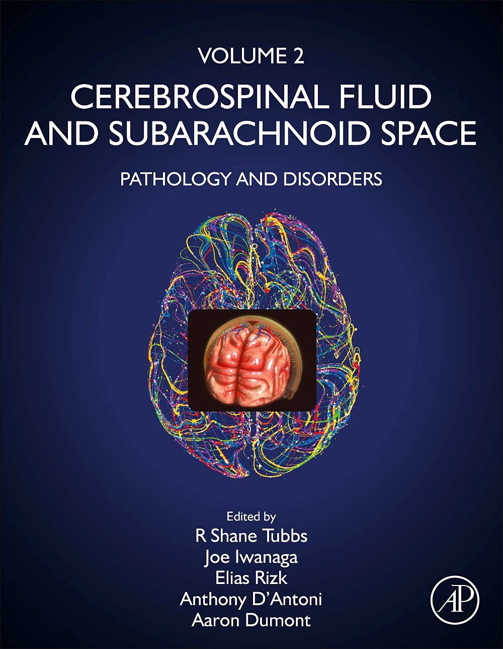 Cerebrospinal Fluid and Subarachnoid Space: Volume 2: Pathology and Disorders