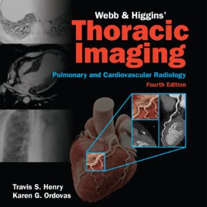 Webb & Higgins Thoracic Imaging: Print + eBook with Multimedia-ISBN: 9781975199388
