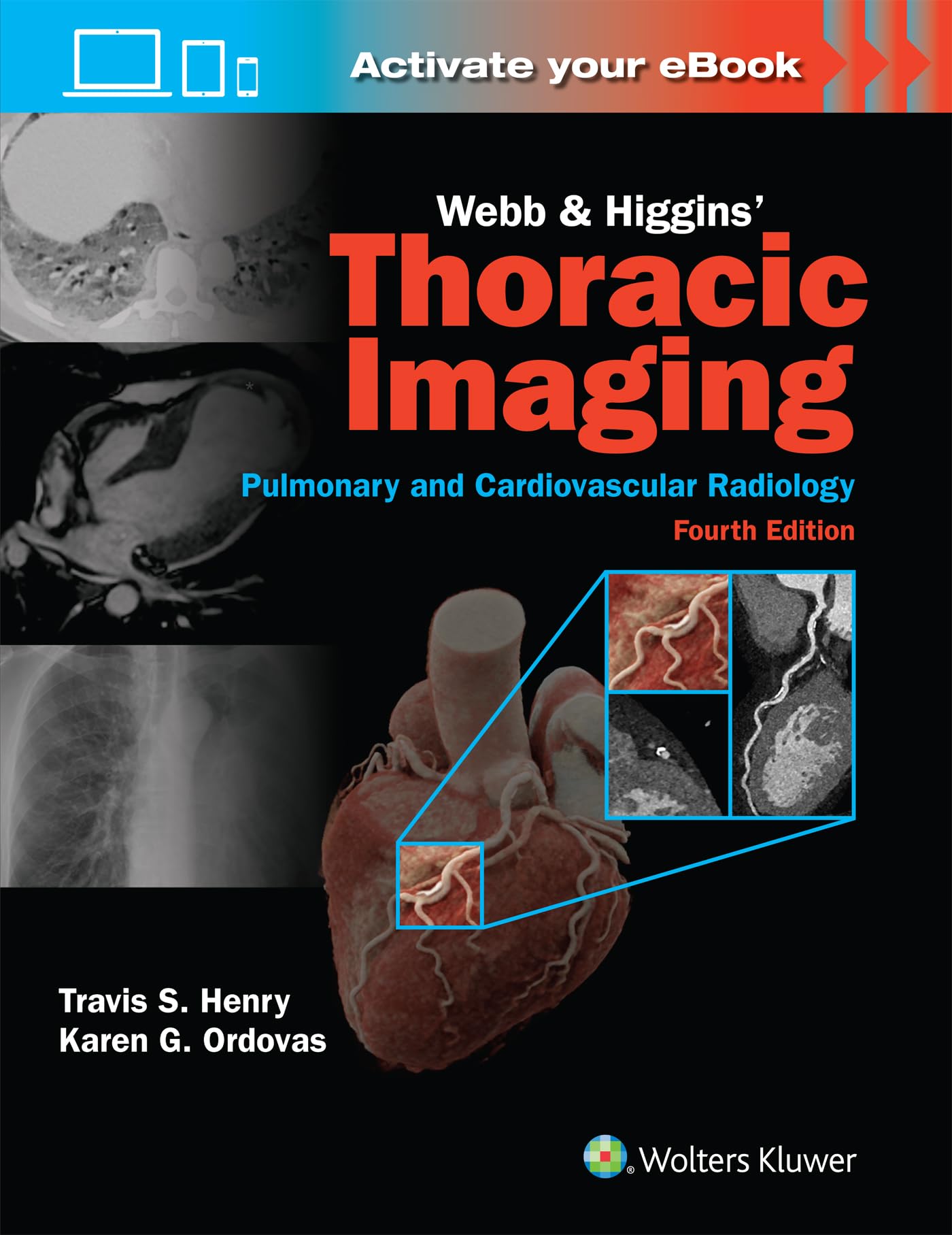 Webb & Higgins Thoracic Imaging: Print + eBook with Multimedia-ISBN: 9781975199388