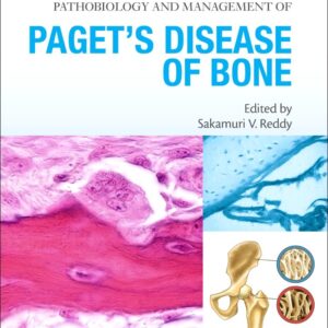 Advances in Pathobiology and Management of Pagetâ€™s Disease of Bone